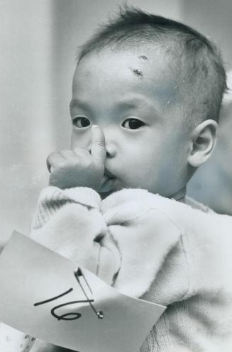 A year-old vietnamese orphan girl on her way to a new home in Cananda waits for a medical examination in Toronto last week. Buddhist nuns in Viet Nam oppose sending waifs aboard for adoption