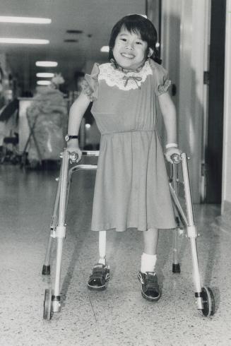 Getting stronger, Win Htut, 5, separated from her Siamese twin brother Lin in Toronto in 1984, has been fitted with an artificial leg. She can't use c(...)