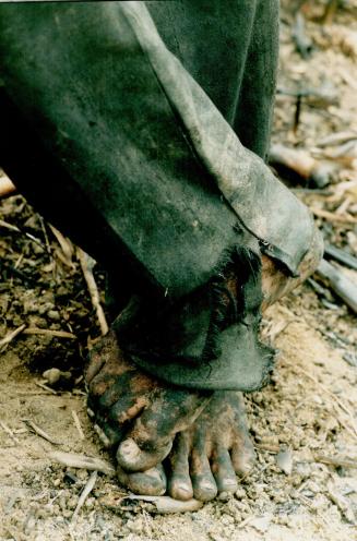 Feet of 15 yr old working in cane field