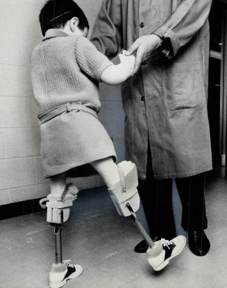 Five-year-old tests new knee joints, They're cutaway models to show inner workings