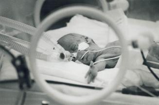 Fight for survival: A tangle of tubes and wires engulfs tiny Bianca Scarpone, keeping the 14-weeks-premature tot alive in a small, transparent incubator at Toronto's Mount Sinai Hospital