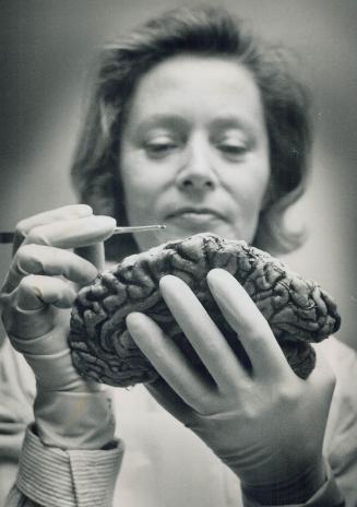 Scientific work: Maria Pataki, tissue co-ordinator for the Canadian Brain Tissue Bank, checks a preserved half-section of a brain in her lab at the Clarke Institute