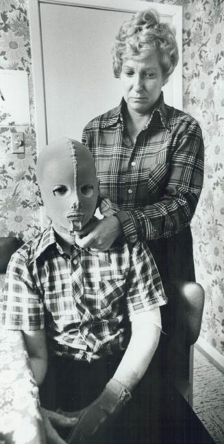 Healing mask: Andy Benerowski, 12, with mother Rose Jenkyn, has to stay covered while skin grafts heal
