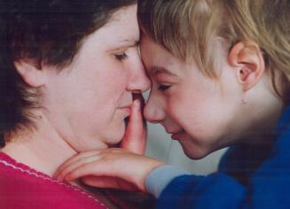 Joan Almey enjoys a tender moment with her 7-year-old son, Tommy, who wasn't expected to survive the genetic disorder trisomy 13. He has every right to live, she says
