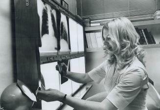 X-Ray Technician Lynda Potvin checks over negatives in radiology department
