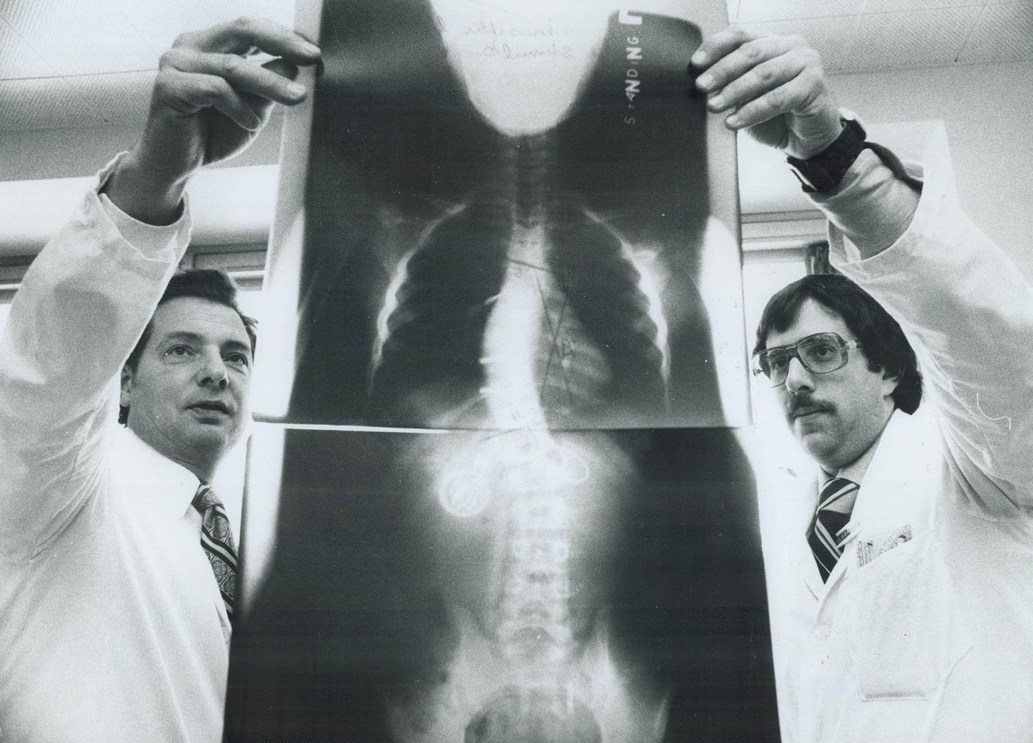 A $139,800 grant from the Atkinson Charitable Foundation will expand research into scoliosis, a hereditary, genetic disease that causes the spine to c(...)
