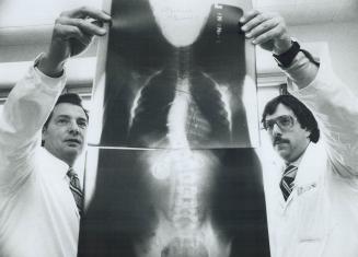 A $139,800 grant from the Atkinson Charitable Foundation will expand research into scoliosis, a hereditary, genetic disease that causes the spine to c(...)