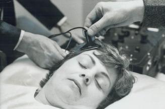 Electrodes are placed on the head of a model patient in a Toronto hospital to simulate an electroshock therapy session