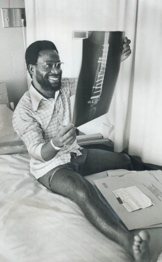 Roland Gabriel beams at X-ray of his knee transplant