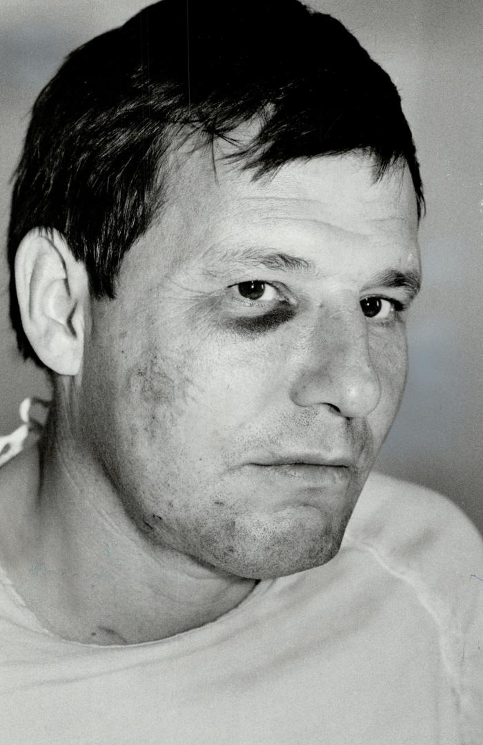Joe Ogle: Soccer referee is recovering from injuries received when he was attacked by two players in game Monday