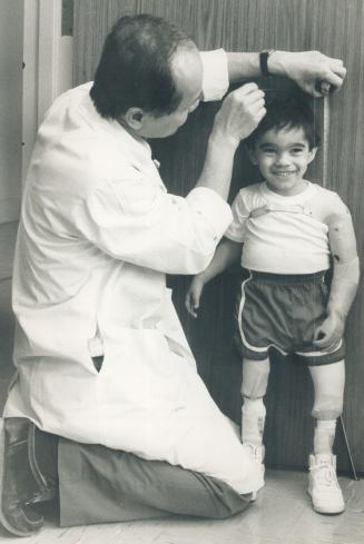 Dr. Linh Le checks four-year-old Angelo Muredda's growth to see if larger replacements for his legs or left arm are needed