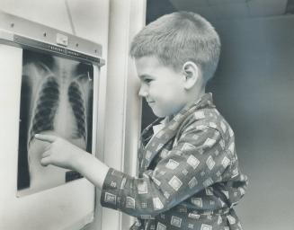 Inside viewpoint No. 1,000,00. Gazing proudly at the x-ray for his chest on the viewer in front of him at the Hospital for Sick Children, 5-year-old D(...)
