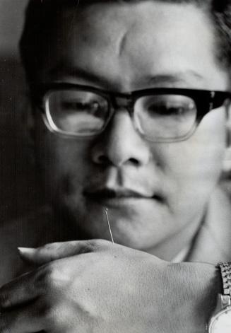 Young Hai Tee shows acupuncture needle