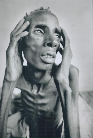 Sudanese famine victim Kuol Dut