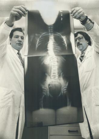 A $139,800 Grant from the Atkinson Charitable Foundation will expand research into scoliosis, a hereditary, genetic disease that causes the spine to c(...)