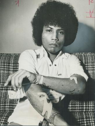 David Persaud, Shows machete wounds