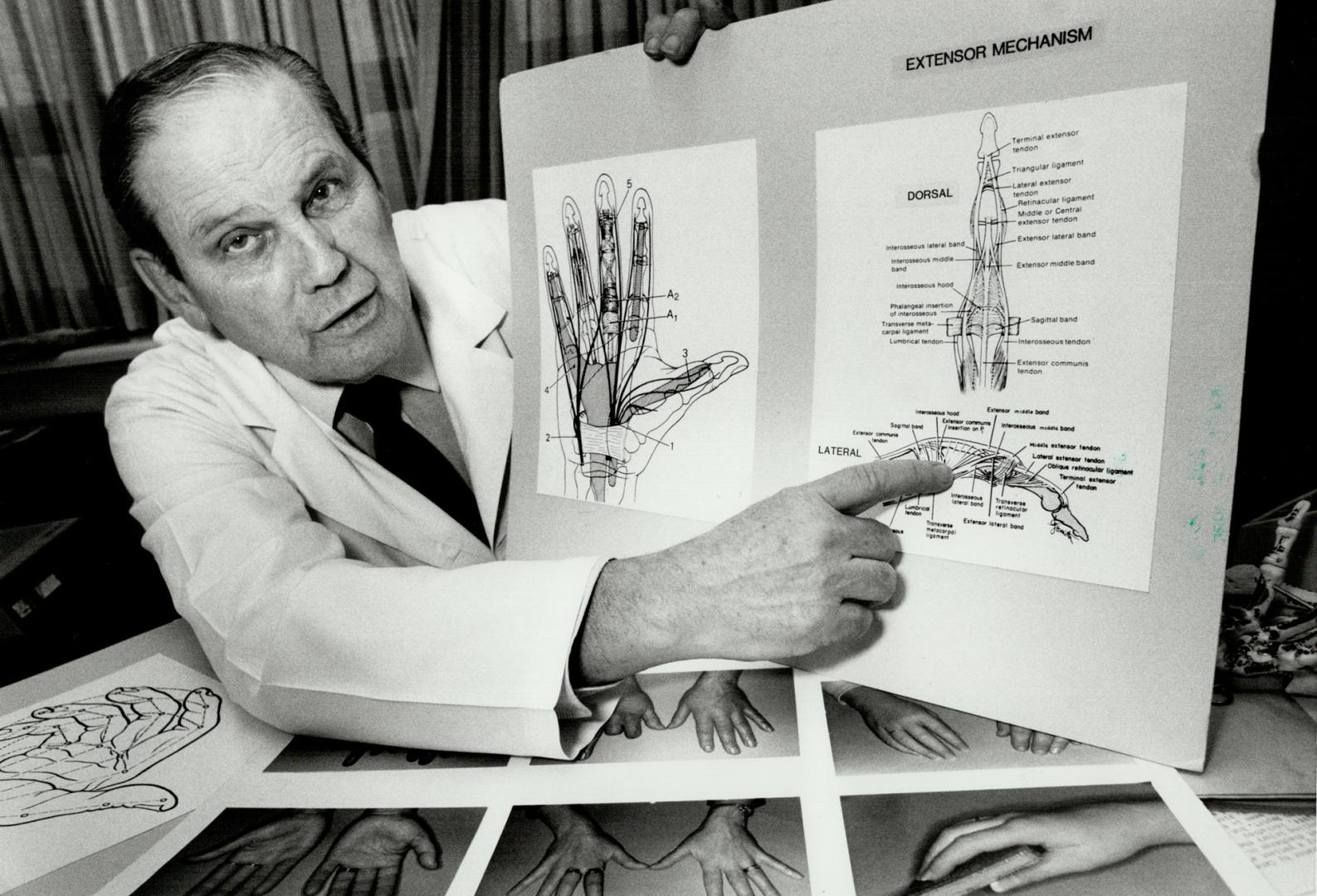 How it works: Dr. John MacKenzie, who recently retired as co-ordinator of the hand clinic at the Workers' Compensation Board's Downsview Rehabilitation Centre, uses a diagram to explain injuries to workers who are sent to the clinic for treatment. he hopes to continue his research into hand injuries.