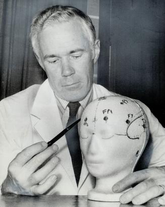 Neurologist Robert McPhedran, who is testing new drug to ward off migraine headaches, uses model to show where attack may be left.