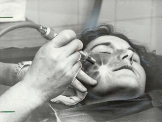 Goodby, birthmark. Her face frozen, lies on an operating table at Toronto General Hospital as plastic surgeon. Dr. Robert Newton erases a deep red birthmakr with a laser beam. Newton says three or four sessions will be needed and it will take six to eight months to see the full effect.