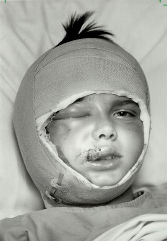 Dog attack: The face of Robert Luburic, 9, bears the wounds of a savage attack by 120 pound Alaskan malamute after he chased a ball into a Mississauga neighbor's yard